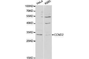 Western Blotting (WB) image for anti-Cyclin D2 (CCND2) antibody (ABIN1875413) (Cyclin D2 antibody)