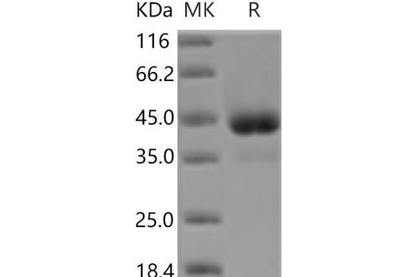 ACVR1 Protein (Fc Tag)