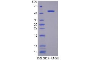 SDS-PAGE (SDS) image for Triadin (TRDN) (AA 344-693) protein (His tag) (ABIN4989693) (Triadin Protein (TRDN) (AA 344-693) (His tag))