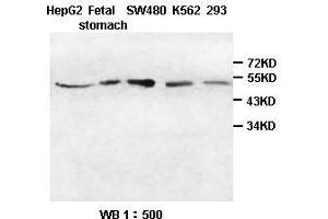 Image no. 1 for anti-Suppression of Tumorigenicity 13 (ST13) antibody (ABIN791160) (HSC70 Interacting Protein HIP antibody)