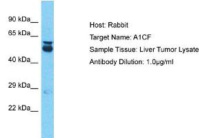 Host: Rabbit Target Name: A1CF Sample Type: Liver Tumor lysates Antibody Dilution: 1. (A1CF antibody  (N-Term))