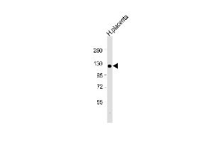 Anti-ITGA2B(Integrin alpha-IIb heavy chain) Antibody (C-term) at 1:2000 dilution + human placenta lysate Lysates/proteins at 20 μg per lane. (Integrin Alpha2b antibody  (C-Term))