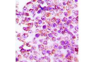 Immunohistochemical analysis of Claudin 4 staining in human tonsil formalin fixed paraffin embedded tissue section. (Claudin 4 antibody  (C-Term))