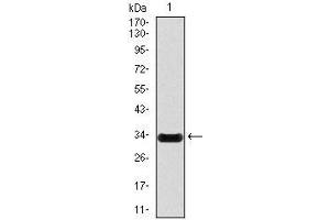 Western Blotting (WB) image for anti-Nitric Oxide Synthase 2, Inducible (NOS2) antibody (ABIN969551)