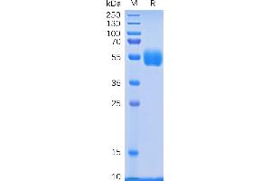 Human NKp30 Protein, hFc Tag on SDS-PAGE under reducing condition. (NCR3 Protein (AA 19-135) (Fc Tag))