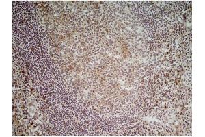 Immunohistochemistry (Frozen Sections) (IHC (fro)) image for anti-CD70 Molecule (CD70) antibody (ABIN316748) (CD70 antibody)