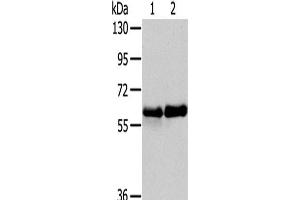 Western Blot analysis of Human fetal brain and Mouse brain tissue using PAK3 Polyclonal Antibody at dilution of 1/200 (PAK3 antibody)