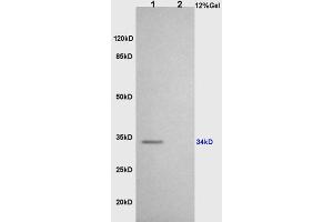L1 rat brain lysates L2 rat heart lysates probed with Anti CD86/B7-2 Polyclonal Antibody, Unconjugated (ABIN736701) at 1:200 overnight at 4 °C. (CD86 antibody  (AA 140-175))