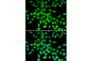 Immunofluorescence analysis of  cells using SERPIN antibody . (SERPINA10 antibody  (AA 165-444))