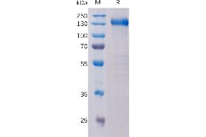 PTK7 Protein (AA 31-704) (Fc Tag)