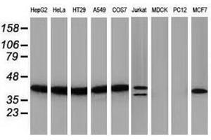 PIH1D2 antibody