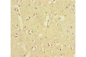 Immunohistochemistry of paraffin-embedded human brain tissue using ABIN7176535 at dilution of 1:100 (ZNF8 antibody  (AA 1-300))