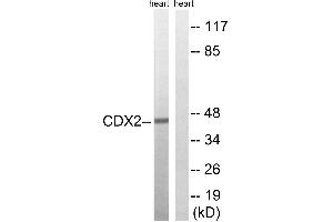 Western blot analysis of extracts from rat heart cells, using CDX2 (Ab-283) antibody. (CDX2 antibody  (Ser283))