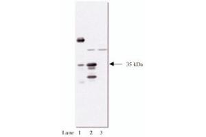 Western Blotting (WB) image for anti-HA-Tag antibody (Agarose Beads) (ABIN264383) (HA-Tag antibody  (Agarose Beads))