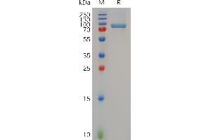 Human , hFc Tag on SDS-PAGE under reducing condition (MMP13 Protein (AA 20-471) (Fc Tag))