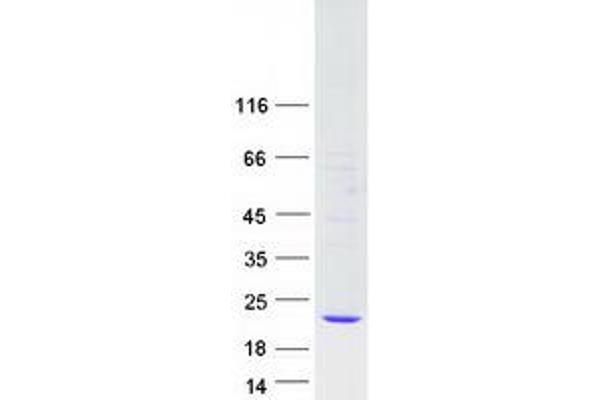 Glutathione Peroxidase 7 Protein (GPX7) (Myc-DYKDDDDK Tag)