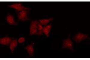 ABIN6269403 staining COS7 by IF/ICC. (DARPP32 antibody)