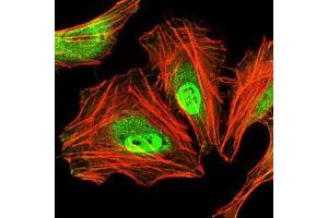 Immunofluorescence (IF) image for anti-CCAAT/enhancer Binding Protein (C/EBP), alpha (CEBPA) antibody (ABIN969048)