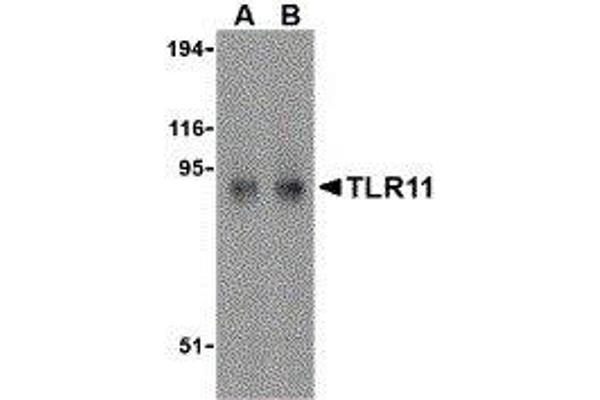 TLR11 antibody  (C-Term)