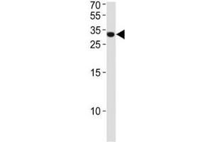 ASCL1 antibody western blot analysis in NCI-H460 lysate. (ASCL1 antibody  (AA 63-90))