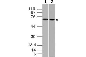 Image no. 1 for anti-Endoglin (ENG) (AA 43-287) antibody (ABIN5027186) (Endoglin antibody  (AA 43-287))