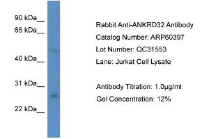 Western Blotting (WB) image for anti-Ankyrin Repeat Domain 32 (ANKRD32) (N-Term) antibody (ABIN2774286) (ANKRD32 antibody  (N-Term))