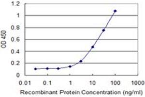 Detection limit for recombinant GST tagged HDAC6 is 0. (HDAC6 antibody  (AA 1-1063))