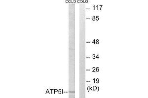 Western Blotting (WB) image for anti-ATP Synthase, H+ Transporting, Mitochondrial F0 Complex, Subunit E (ATP5I) (Internal Region) antibody (ABIN1850821) (ATP5I antibody  (Internal Region))