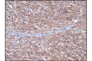 Image no. 1 for anti-Mast/stem Cell Growth Factor Receptor (KIT) (C-Term) antibody (ABIN1493320) (KIT antibody  (C-Term))