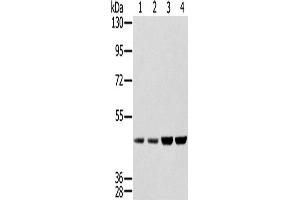 Western Blotting (WB) image for anti-Sjogren Syndrome Antigen B (SSB) antibody (ABIN2427329) (SSB antibody)