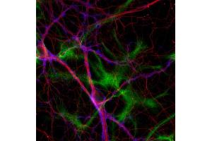 Immunocytochemistry (ICC) image for anti-Tubulin delta 2 (AA 443-449) antibody (ABIN1742551) (Tubulin delta 2 (AA 443-449) antibody)