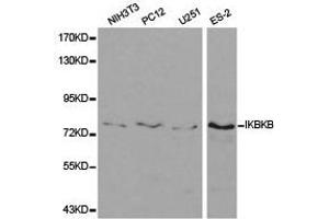 Western Blotting (WB) image for anti-Inhibitor of kappa Light Polypeptide Gene Enhancer in B-Cells, Kinase beta (IKBKB) antibody (ABIN1873179) (IKBKB antibody)