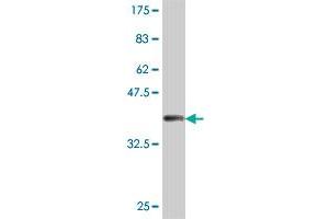 Western Blot detection against Immunogen (38. (PNMT antibody  (AA 1-110))