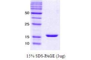 Figure annotation denotes ug of protein loaded and % gel used. (alpha Synuclein E46K (active) Protein)