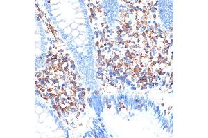 Immunohistochemistry of paraffin-embedded human appendix using ELMO1 Rabbit mAb (ABIN7266951) at dilution of 1:100 (40x lens). (ELMO1 antibody)