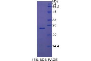 SDS-PAGE analysis of Human GRIP1 Protein. (GRIP1 Protein)