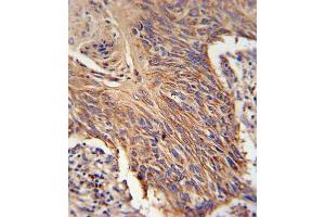 Immunohistochemistry (IHC) image for anti-Retinol Dehydrogenase 10 (All-Trans) (RDH10) antibody (ABIN3002122) (RDH10 antibody)