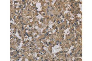 Immunohistochemistry (IHC) image for anti-Dynactin 3 (p22) (Dctn3) antibody (ABIN2423285) (DCTN3 antibody)