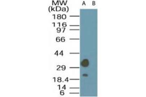 Image no. 1 for anti-STE20-Related Kinase Adaptor alpha (STRADA) (AA 300-350) antibody (ABIN200008) (STRADA antibody  (AA 300-350))