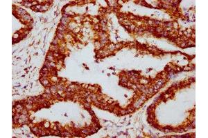 Immunohistochemistry (IHC) image for anti-Peripheral-Type Benzodiazepine Receptor (TSPO) antibody (ABIN7127858)