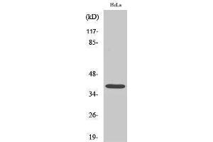 Western Blotting (WB) image for anti-Nucleophosmin (Nucleolar phosphoprotein B23, Numatrin) (NPM1) (N-Term) antibody (ABIN3185974) (NPM1 antibody  (N-Term))