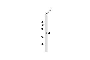 Anti-ETV1 Antibody (N-Term)at 1:1000 dilution + human brain lysates Lysates/proteins at 20 μg per lane. (ETV1 antibody  (AA 32-65))