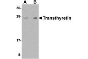 Western blot analysis of Transthyretin in human lung tissue lysate with Transthyretin antibody at (A) 1 and (B) 2 μg/ml. (TTR antibody  (Center))