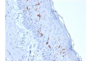 Immunohistochemistry (IHC) image for anti-CD1a (CD1a) antibody (ABIN6941002)