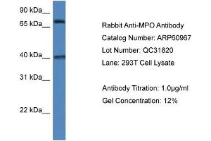 Western Blotting (WB) image for anti-Myeloperoxidase (MPO) (N-Term) antibody (ABIN786303) (Myeloperoxidase antibody  (N-Term))