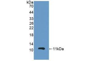 Figure. (GPX3 antibody  (AA 3-72))