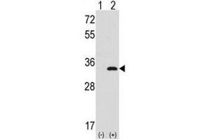 Image no. 2 for anti-Cyclin-Dependent Kinase 1 (CDK1) (N-Term) antibody (ABIN357035) (CDK1 antibody  (N-Term))