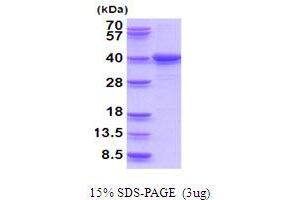 SDS-PAGE (SDS) image for Leucine Zipper Transcription Factor-Like 1 (LZTFL1) (AA 1-299) protein (His tag) (ABIN5854031) (LZTFL1 Protein (AA 1-299) (His tag))