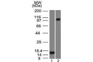 Western blot testing of 1) recombinant partial protein and 2) human ThP1 lysate with Thrombomodulin antibody (clone THBD/1591). (Thrombomodulin antibody  (AA 69-194))