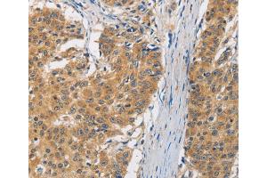 Immunohistochemistry (IHC) image for anti-Fas-Activated serine/threonine Kinase (FASTK) antibody (ABIN2428123) (FASTK antibody)